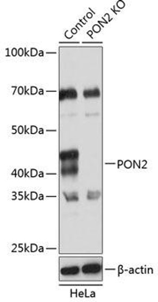 Anti-PON2 Antibody (CAB19853)[KO Validated]