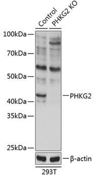 Anti-PHKG2 Antibody (CAB19934)[KO Validated]