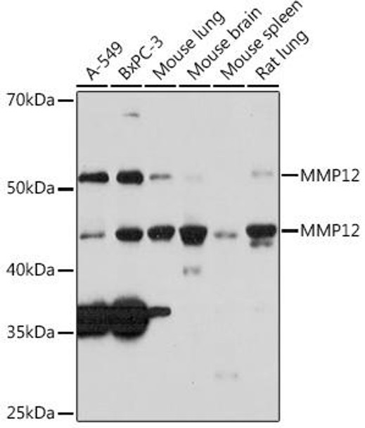 Anti-MMP12 Antibody (CAB3713)