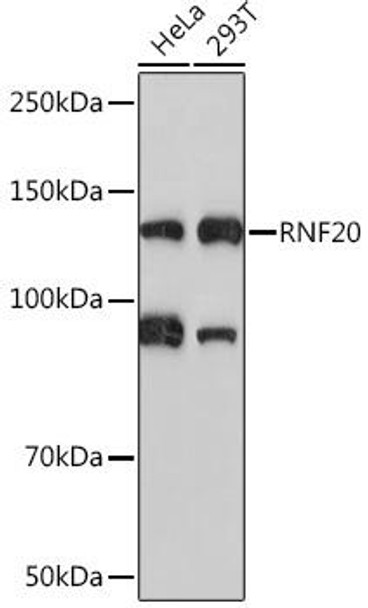 Anti-RNF20 Antibody (CAB4784)