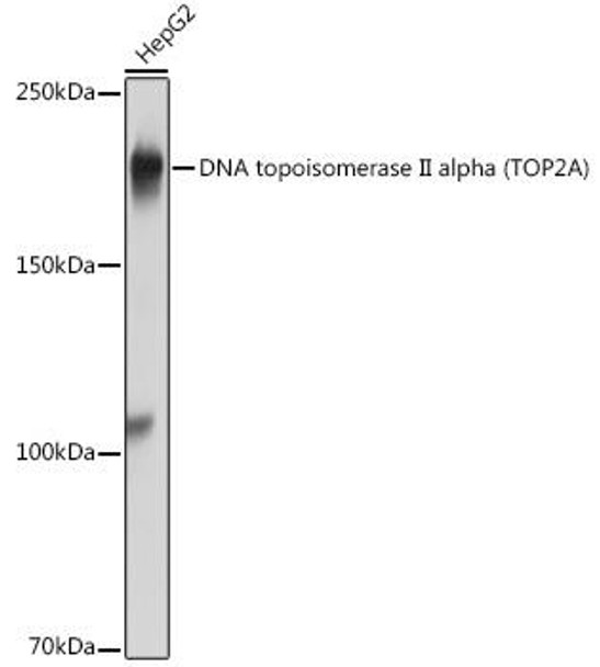 Anti-DNA topoisomerase II alpha (TOP2A) Antibody (CAB0726)