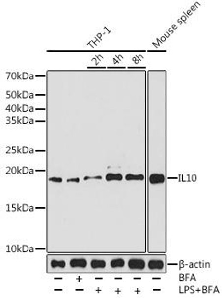 Anti-IL10 Antibody (CAB12255)