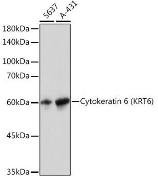 Anti-Cytokeratin 6 (KRT6) Antibody (CAB4631)