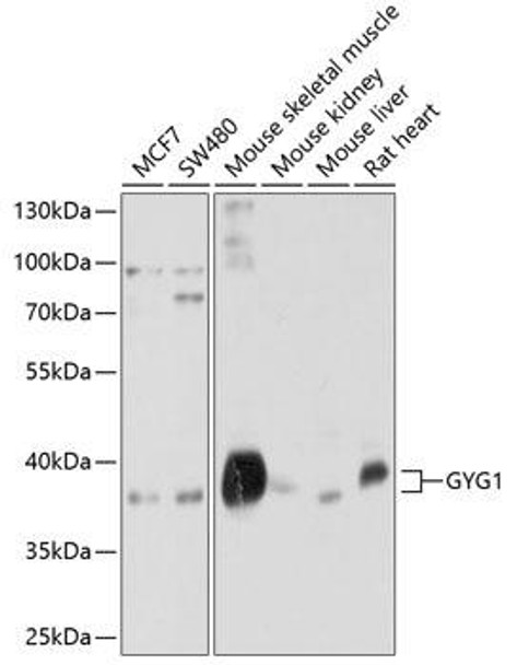Anti-GYG1 Antibody (CAB10218)