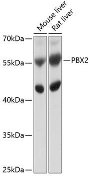 Anti-PBX2 Antibody (CAB10233)