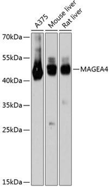 Anti-MAGEA4 Antibody (CAB11607)