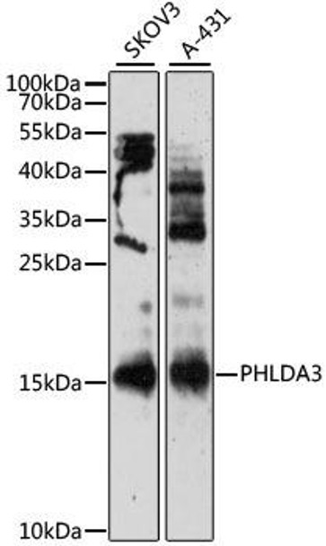 Anti-PHLDA3 Antibody (CAB12666)