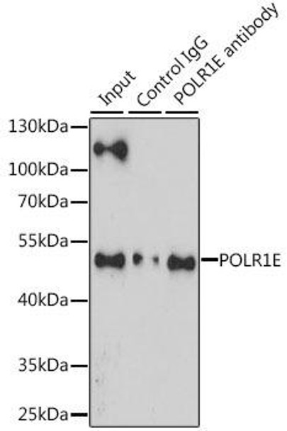 Anti-POLR1E Antibody (CAB12700)