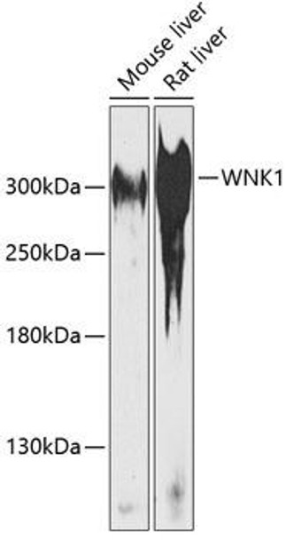 Anti-WNK1 Antibody (CAB14196)