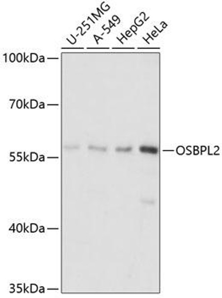 Anti-OSBPL2 Antibody (CAB14199)