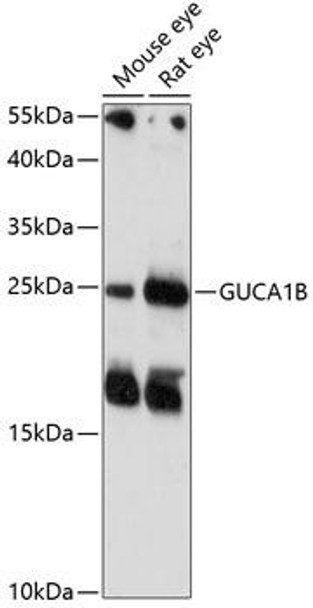 Anti-GUCA1B Antibody (CAB14739)
