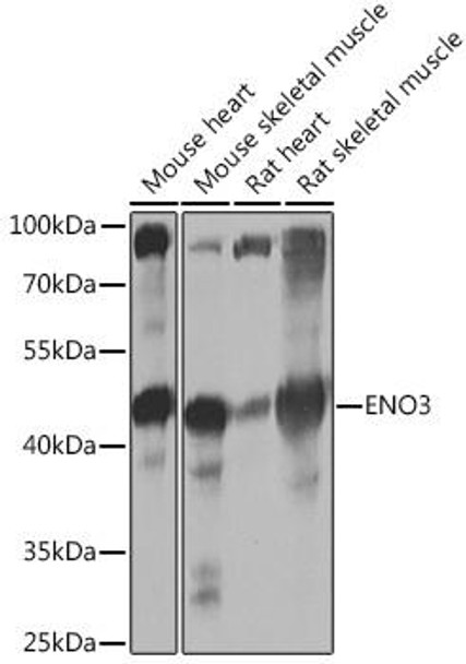 Anti-ENO3 Antibody (CAB16371)