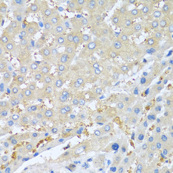 Anti-PPBP Antibody (CAB1925)