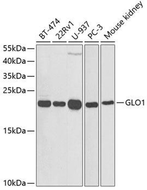 Anti-GLO1 Antibody (CAB1932)