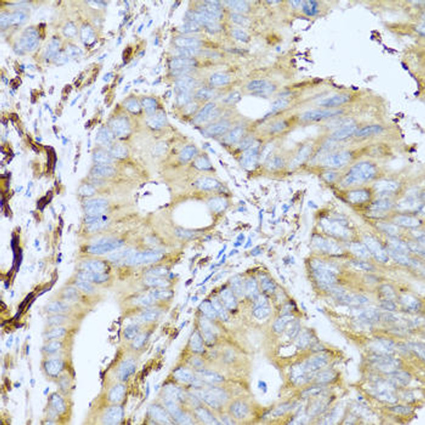 Anti-CSH1 Antibody (CAB1972)