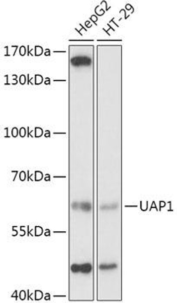 Anti-UAP1 Antibody (CAB2119)