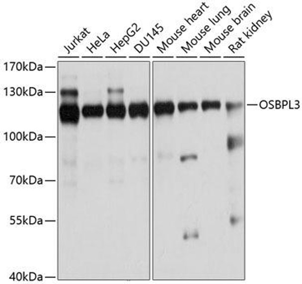 Anti-OSBPL3 Antibody (CAB4604)