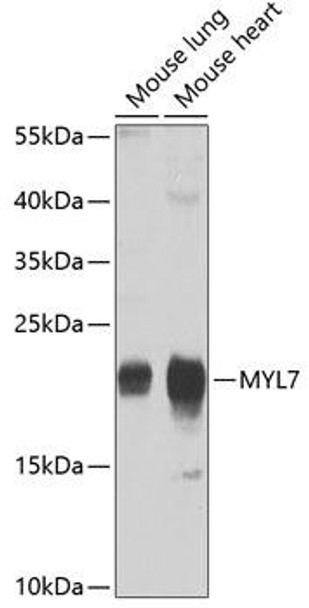 Anti-MYL7 Antibody (CAB4905)