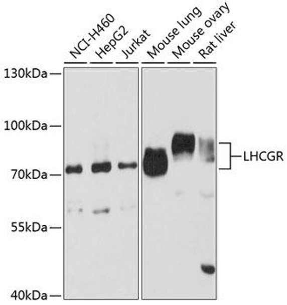 Anti-LHCGR Antibody (CAB6266)