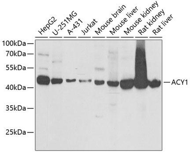 Anti-ACY1 Antibody (CAB6351)