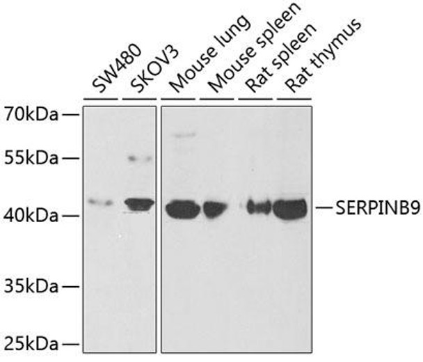 Anti-SERPINB9 Antibody (CAB6393)