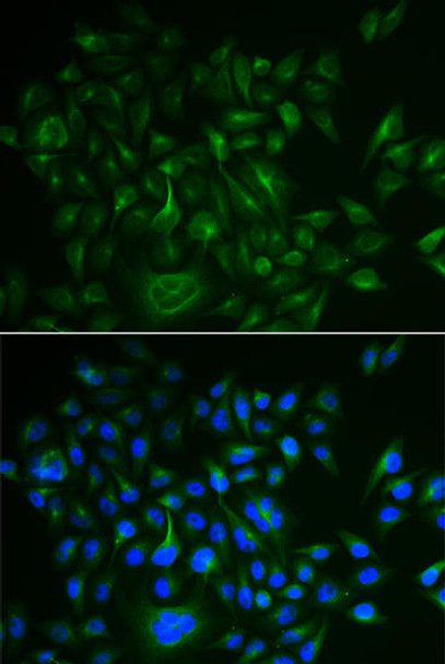 Anti-BAMBI Antibody (CAB6532)