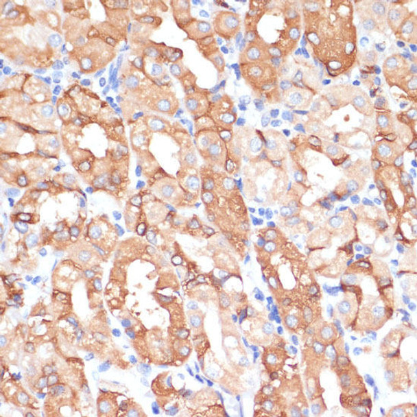 Anti-NHLRC1 Antibody (CAB6669)
