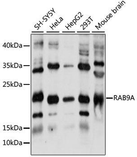 Anti-RAB9A Antibody (CAB7041)