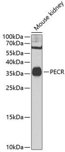 Anti-PECR Antibody (CAB7206)