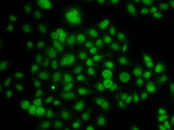 Anti-ATOH7 Antibody (CAB7273)