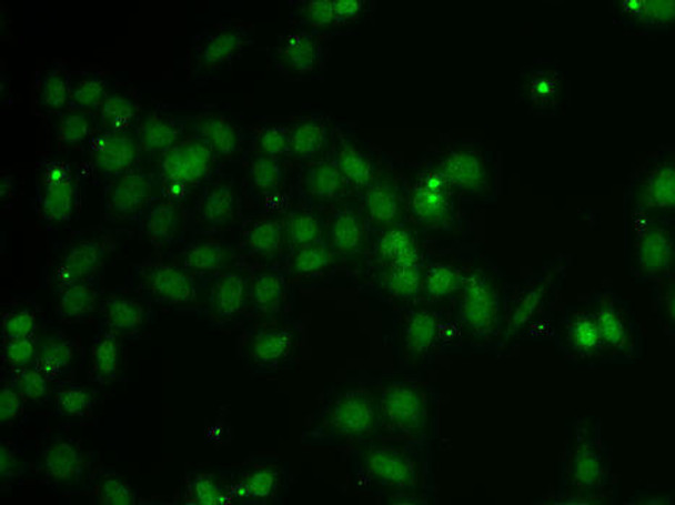 Anti-POU6F1 Antibody (CAB7299)