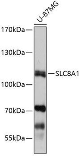 Anti-SLC8A1 Antibody (CAB7419)