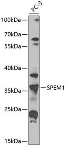 Anti-SPEM1 Antibody (CAB8076)