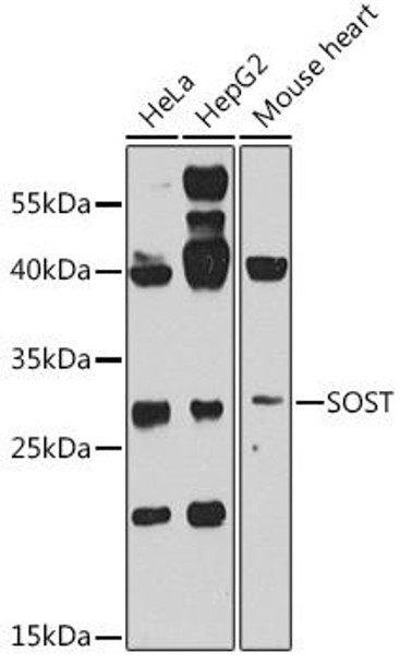 Anti-Sclerostin Antibody (CAB8213)