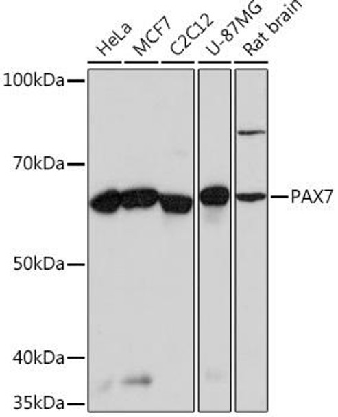 Anti-PAX7 Antibody (CAB4134)