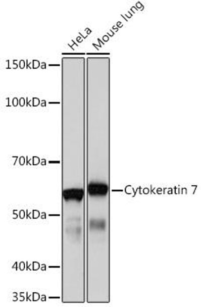 Anti-Cytokeratin 7 Antibody (CAB4357)