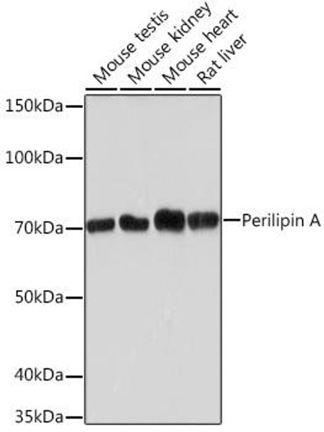 Anti-Perilipin A Antibody (CAB4758)