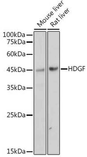 Anti-HDGF Antibody (CAB0589)
