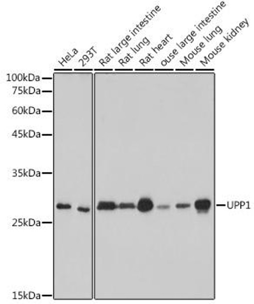 Anti-UPP1 Antibody (CAB0613)