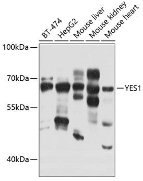 Anti-YES1 Antibody (CAB0628)