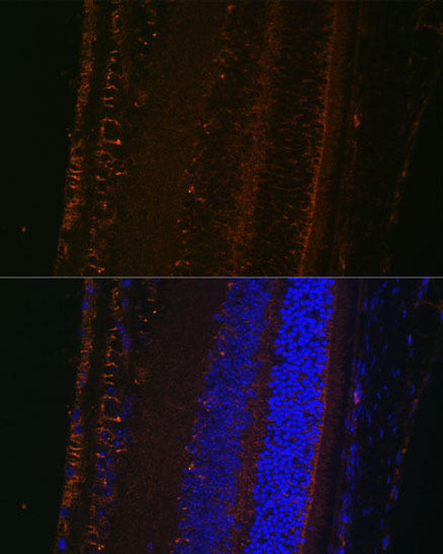 Anti-LOXL1 Antibody (CAB10191)