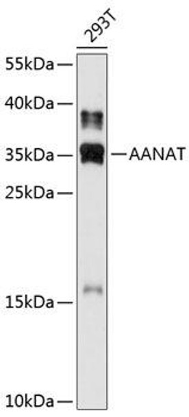Anti-AANAT Antibody (CAB11850)