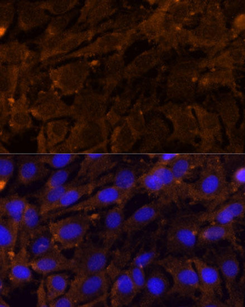 Anti-MMP3 Antibody (CAB1202)