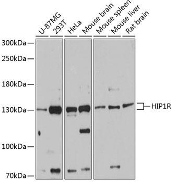 Anti-HIP1R Antibody (CAB12026)