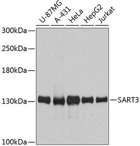 Anti-SART3 Antibody (CAB12124)