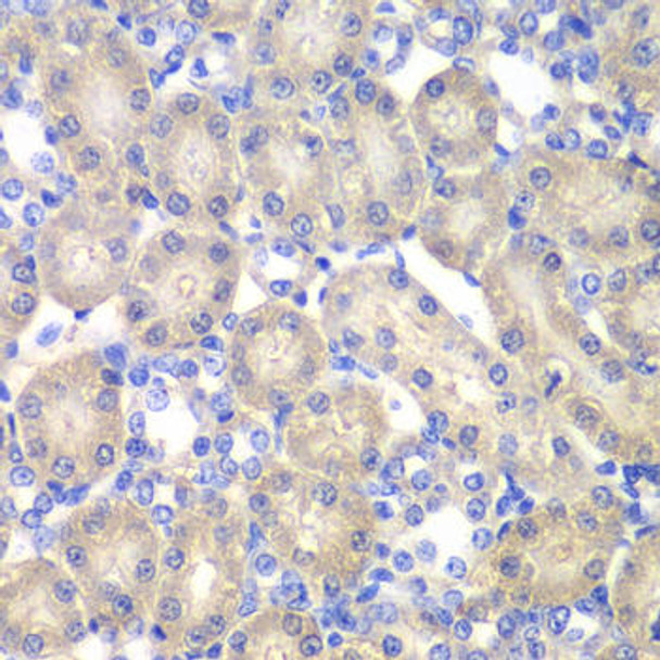 Anti-ACY1 Antibody (CAB13458)