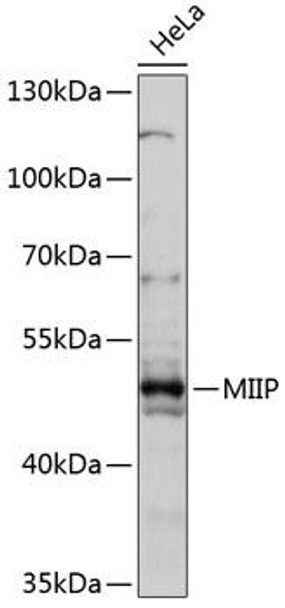Anti-MIIP Antibody (CAB14417)