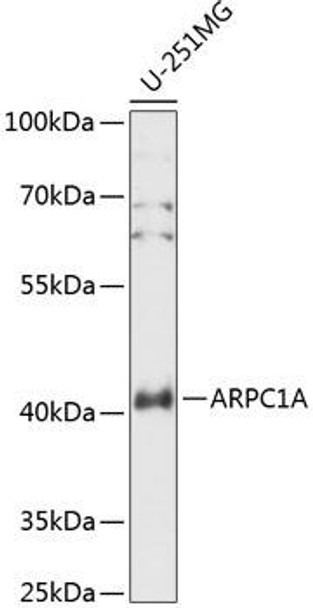 Anti-ARPC1A Antibody (CAB14502)