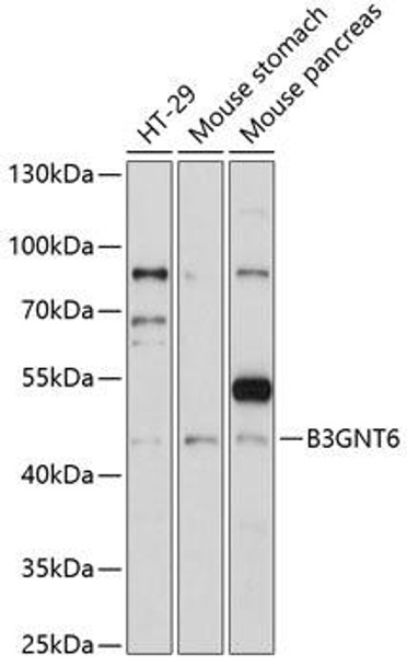 Anti-B3GNT6 Antibody (CAB14974)