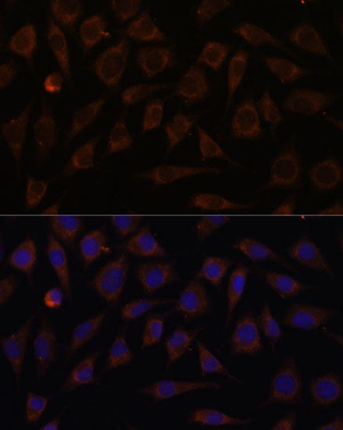 Anti-VILL Antibody (CAB15440)